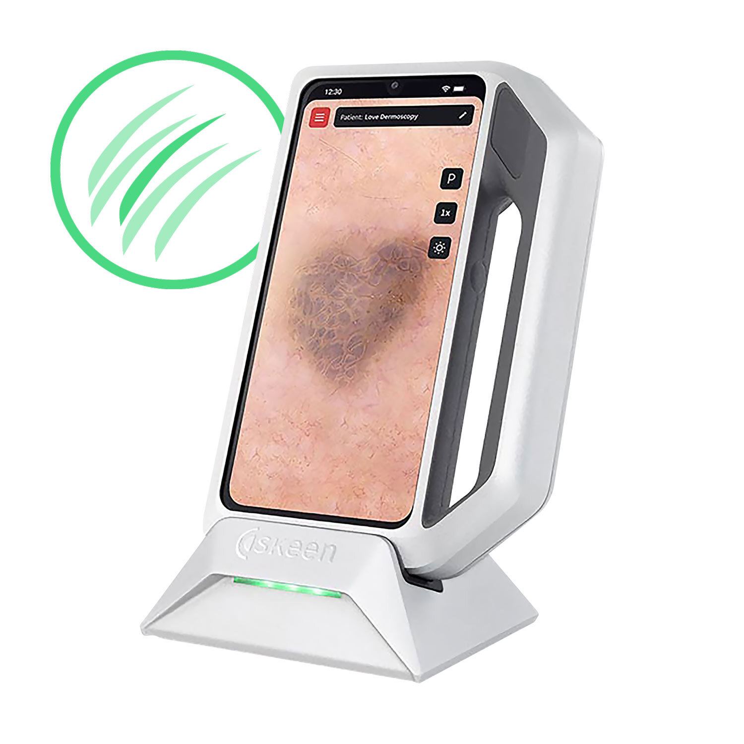 FotoFinder® Trichoscopy Licence