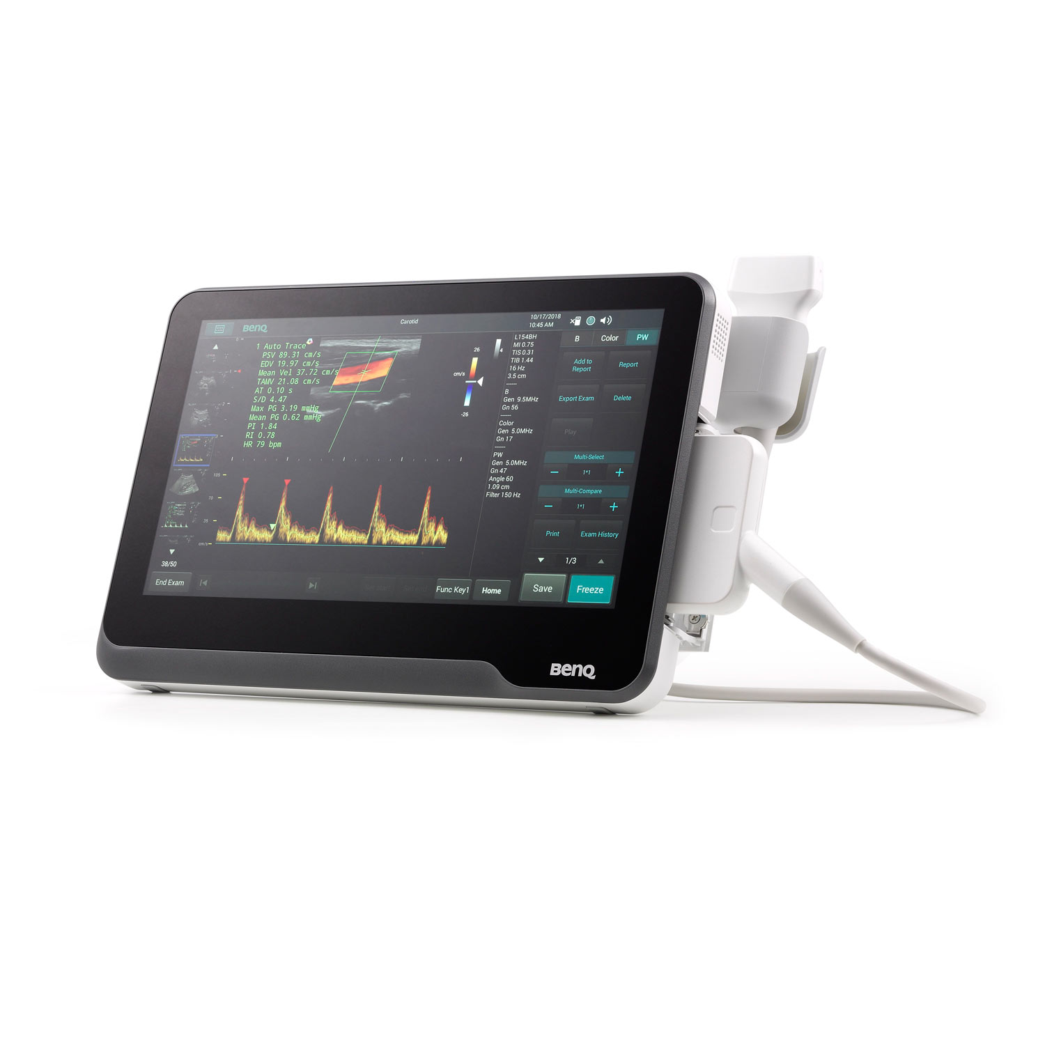 T3300v Ultrasound System