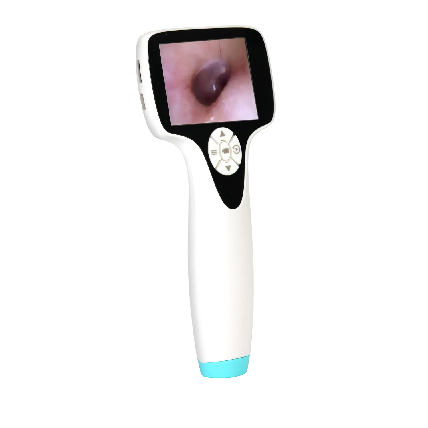 MLTec Video Otoscope/Endoscope