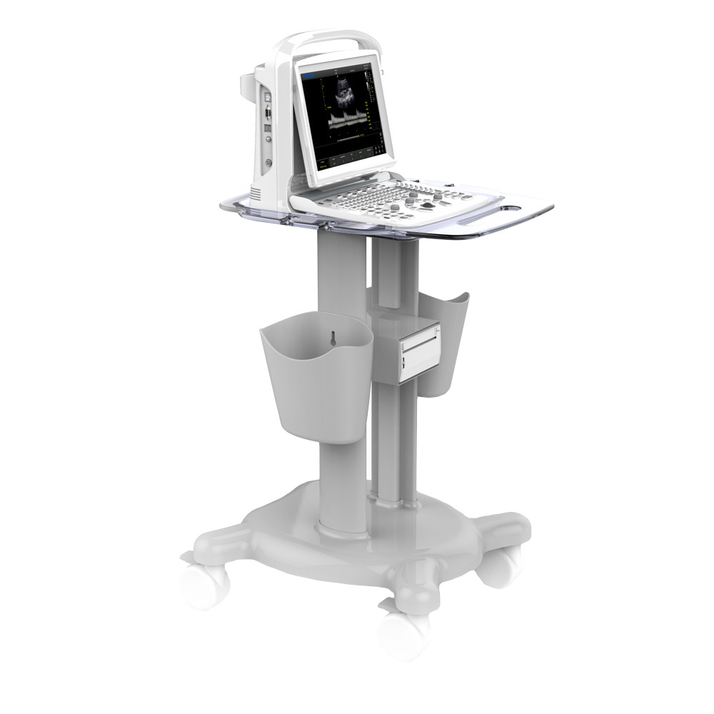 CHISON ECO1 incl. Ultrasound Trolley