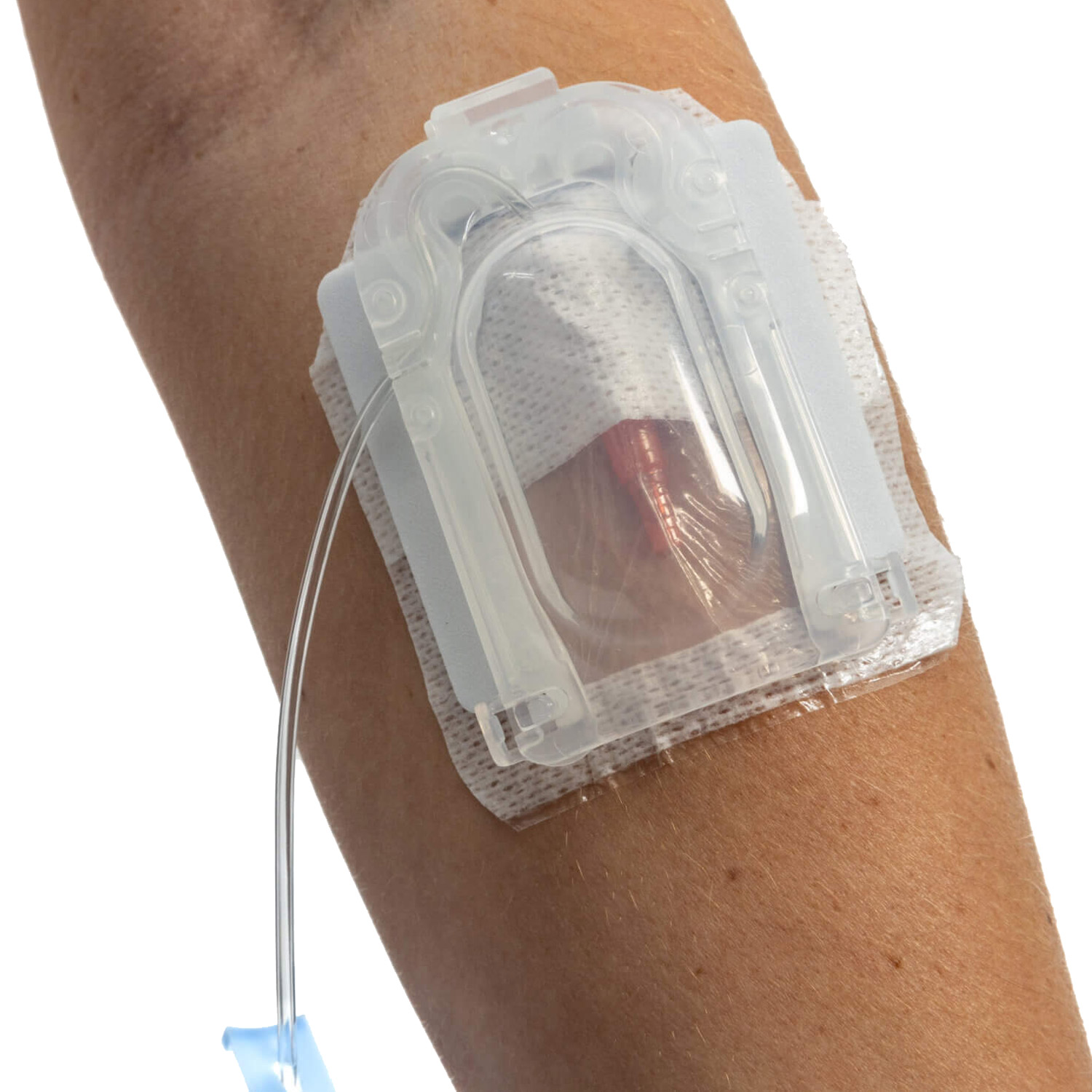 IV Glove Easystick